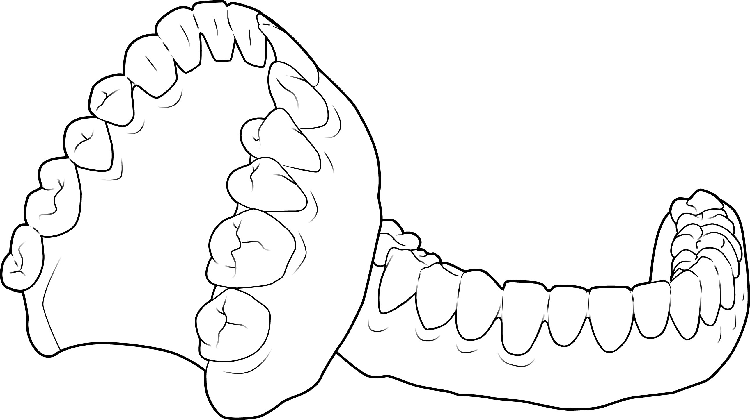 Workflow Guide - Removable Dentures